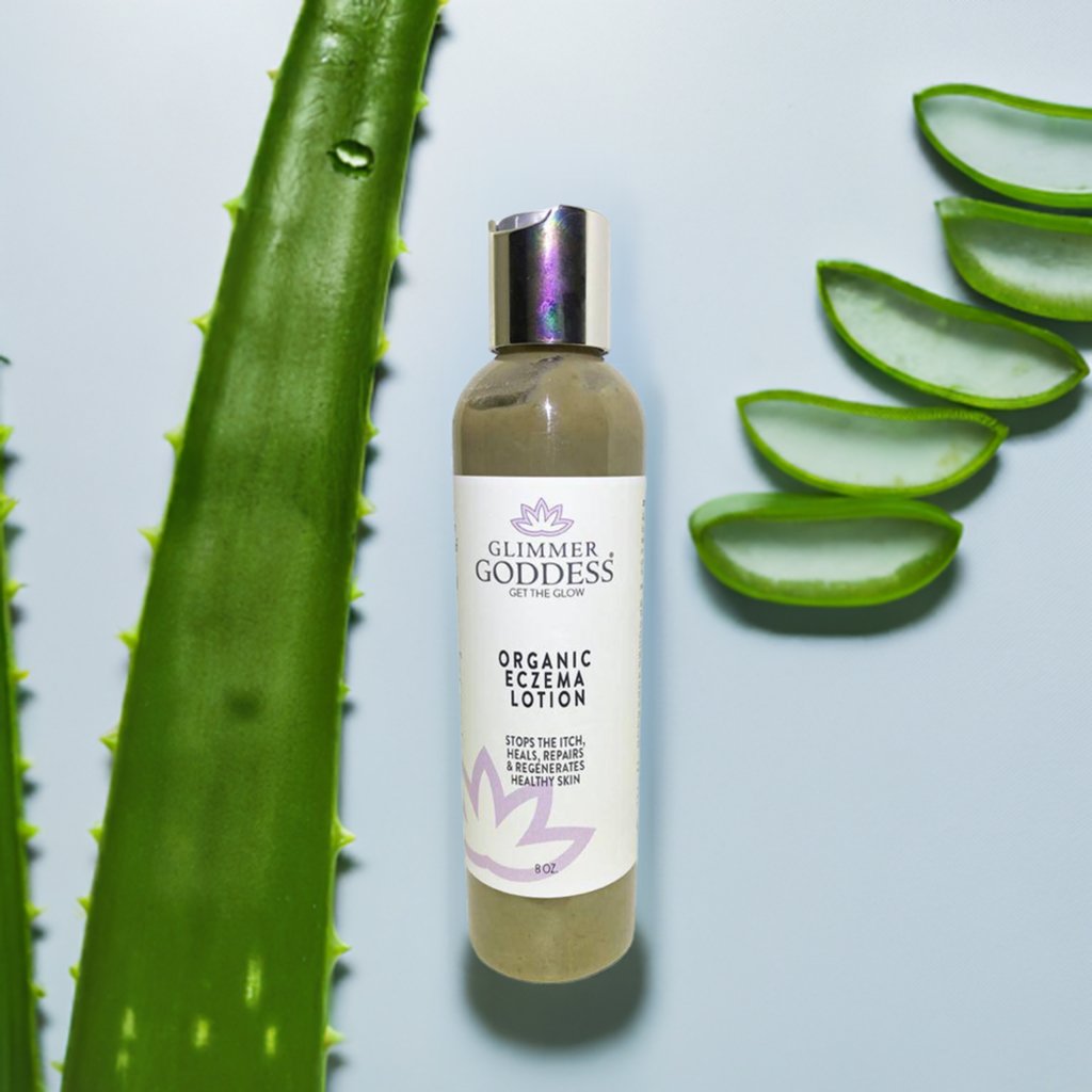 Organic Eczema Lotion – Soothing Relief & Skin Healing