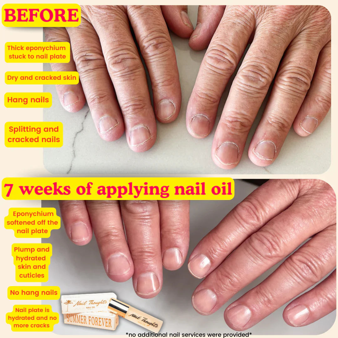 Nail Thoughts - Summer Forever Nail Oil 10ml