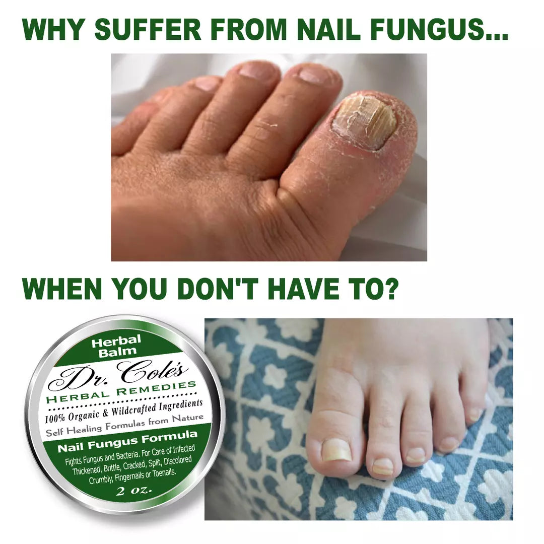Dr. Cole's Nail Fungus Balm SixPak