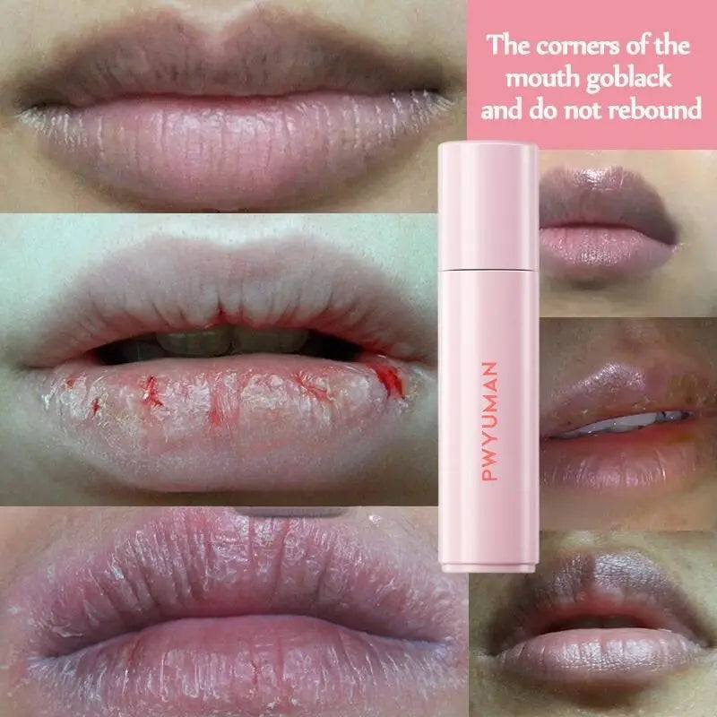 Remove Dark Lip Balm Moisturizing Gloss for Beautiful Lips