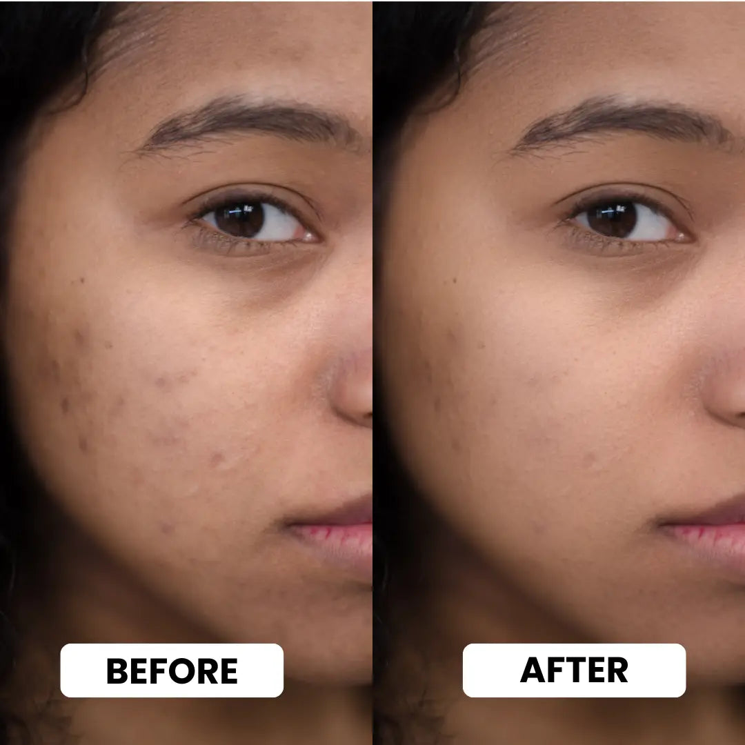 Skin Polish